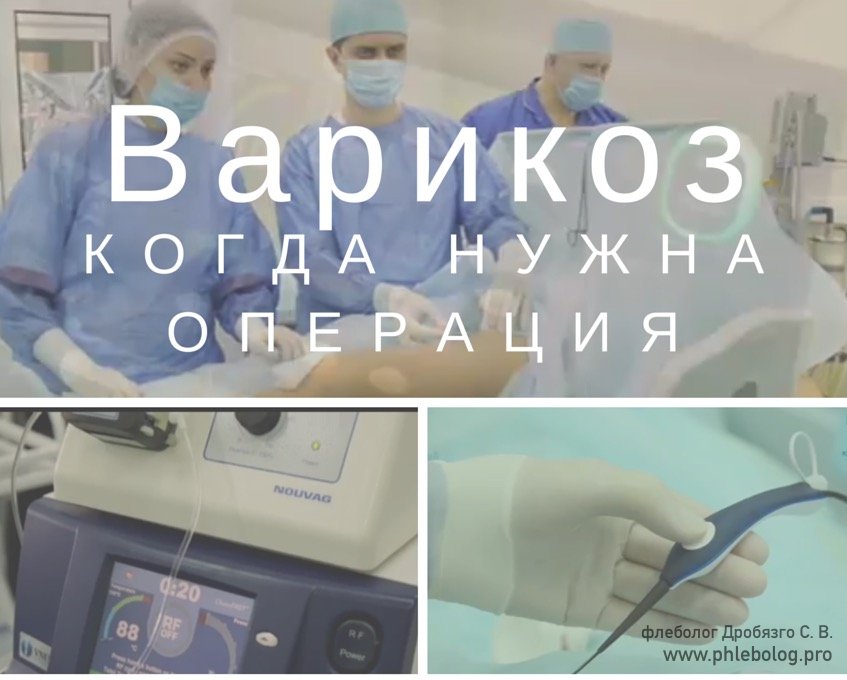 Препараты для склеротерапии вен нижних конечностей
